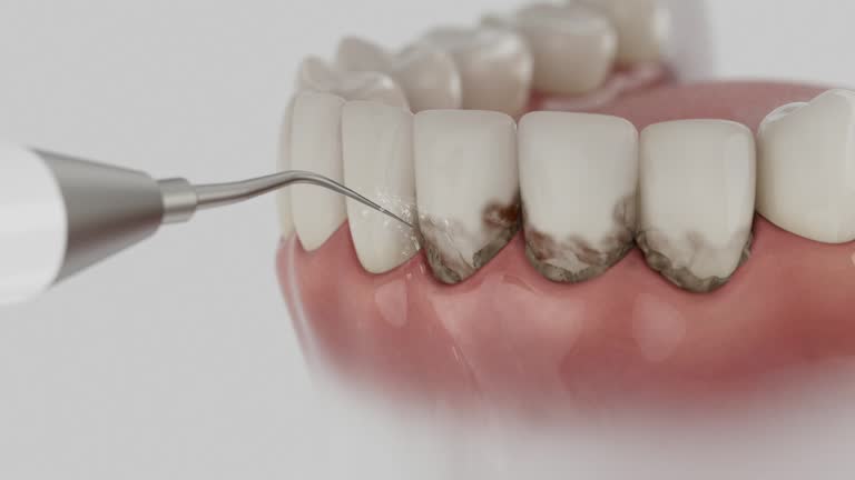 Reliable Dental contractor in Bellefontaine Neighbors, MO by Dentist Open Now